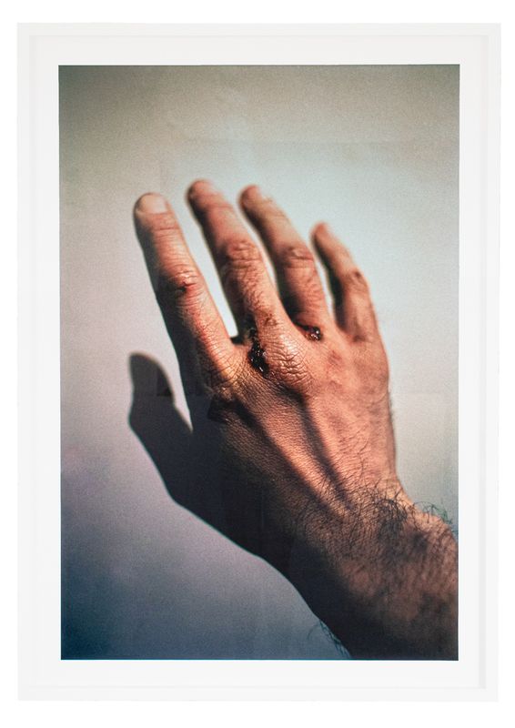 Hand 