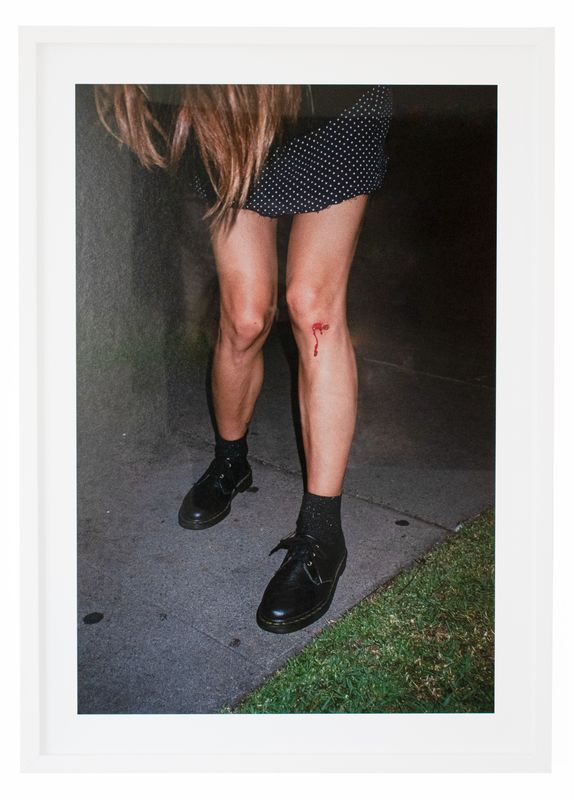 Legs 
